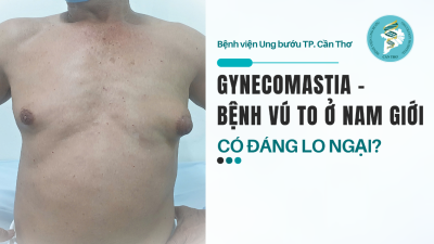 Gynecomastia – Bệnh vú to ở nam giới