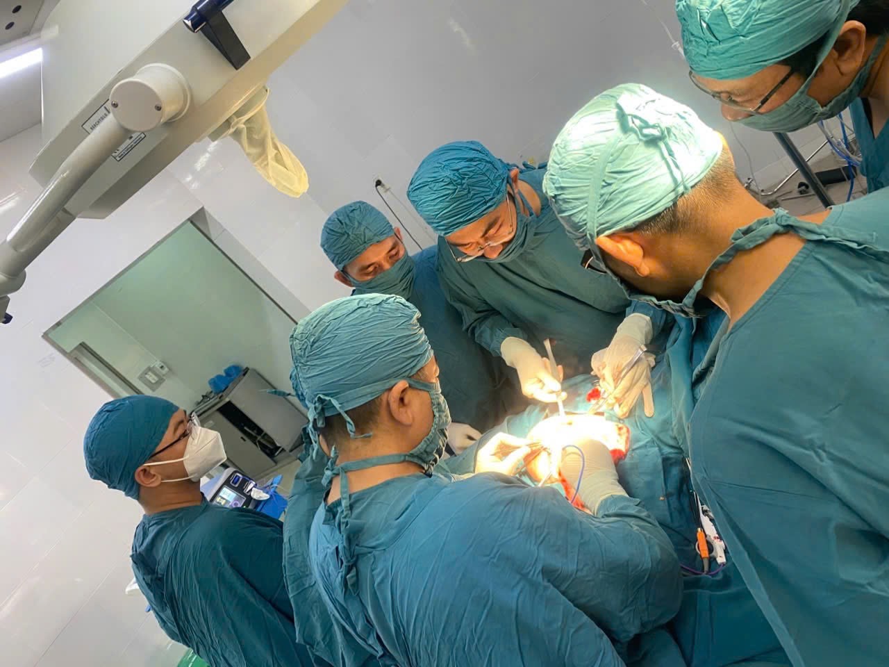Giữ lại nét đẹp, trao lại tự tin: Bệnh viện Ung bướu TP. Cần Thơ chuyển giao thành công kỹ thuật “Đoạn nhũ tiết kiệm da, nạo hạch nách kèm tái tạo vú tức thì bằng vạt da cơ lưng rộng” trong điều trị ung thư tuyến vú